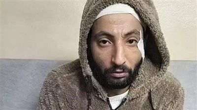 سائق يمزق جسد مواطن أمام زوجته ونجله.. والمجني عليه: أخدت 48 غرزة| بث مباشر