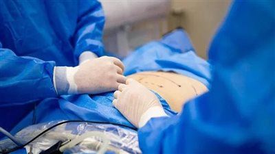 تفاصيل تشويه زوجة مالك مدرسة ماجستي الدولية خلال عملية تجميل