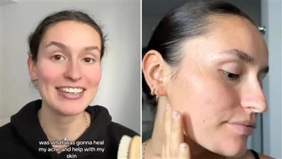 مغسلتش وشها من سنة.. أمريكية تستخدم الدهن كمرطب لحب الشباب