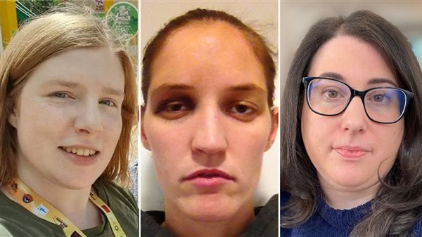 بعض الضحايا