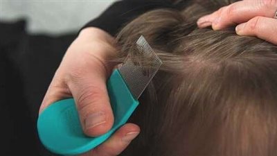 خير الدنيا كله.. تفسير رؤية القمل في الحلم للعزباء والمتزوجة والرجل