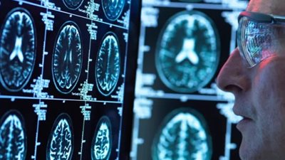 دراسة: الحبوب المنومة البسيطة تساعد في تقليل الإصابة بمرض الزهايمر