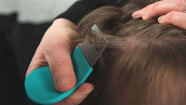 القمل في الحلم للعزباء