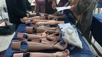 تضامن البحيرة: تسليم 101 طرف صناعي لذوي الهمم بالمحافظة