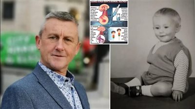 بعد حقنه بهرمونات الجثث.. رجل بريطاني يعيش في رعب الإصابة بمرض خطير