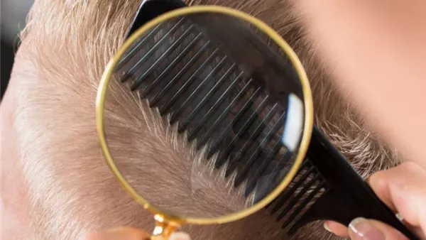 تفسير حلم القمل