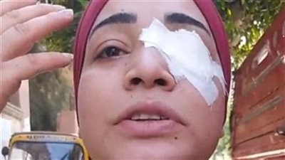 إحالة المتهمة بـ فقء عين ممرضة داخل مستشفى شبرا العام للجنايات