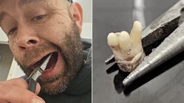 رجل بريطاني يخلع