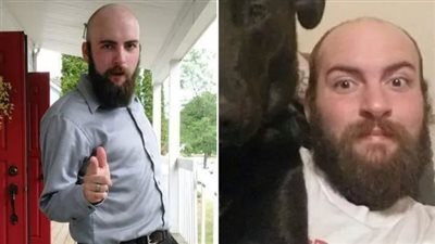 أصيب بثقوب في الرئة.. وفاة شاب أمريكي بعد إصابته بعدوى فطرية مميتة