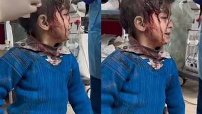 مبخافش.. صغير فلسطيني يتوعد الاحتلال الإسرائيلي خلال معالجته من إصابات القصف برفح 