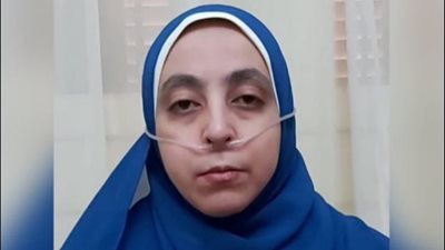 تعاني من تمدد الشعب الهوائية.. فتاة تستغيث لإجراء عملية زراعة الرئة: أتمنى الشيخ محمد بن زايد يتبنى حالتي 