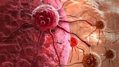 باحثون يكشفون ترابط الشيخوخة البيولوجية بزيادة خطر الإصابة بالسرطان