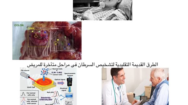 تقنية جديدة للكشف