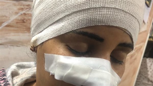 المجنى عليها