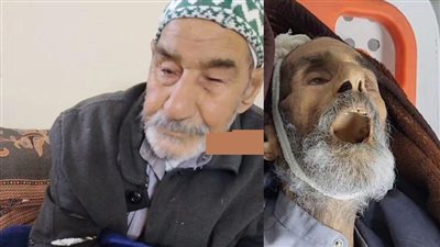 أنباء عن وفاة المسن عبد الرحمن الدحدوح نتيجة المجاعة في غزة