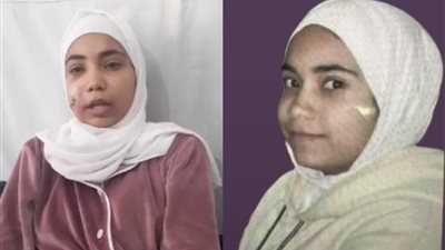 معجزة إنها عايشة.. أسرة حلا حمادة الفلسطينية تكشف لـ القاهرة 24 آخر تطورات حالتها الصحية