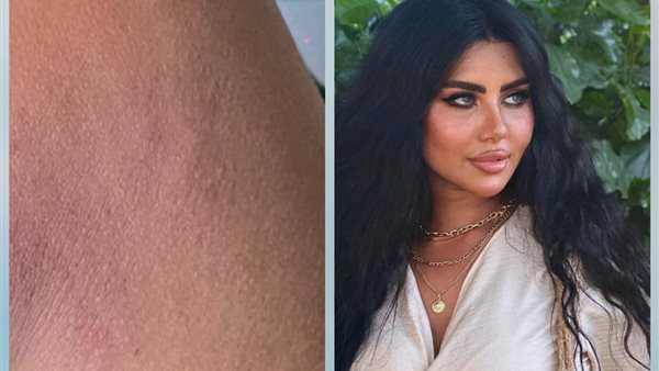 هينار عاطف ضحية اعتداء