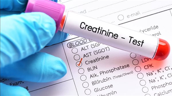 مستوى الكرياتينين
