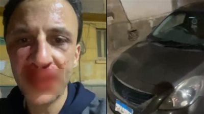 التعدي على مطرب بـ دار الأوبرا بسبب ركنة عربية