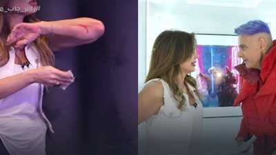 نجلاء بدر تتعرض للإصابة وتنزف في برنامج رامز جاب من الآخر خلال حلقتها مع مي عمر