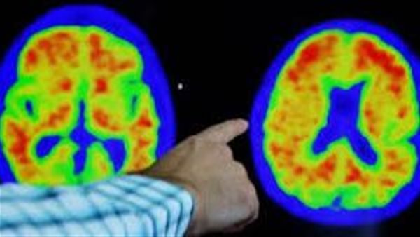 صورة تعبيرية 