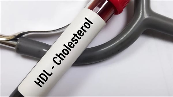 مستويات الكوليسترول