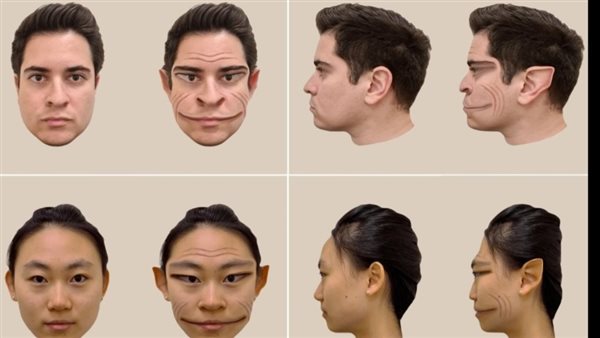 مرض نادر يجعل المريض