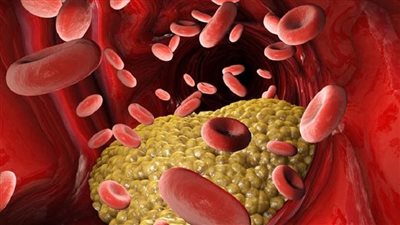 خرافات شائعة عن الكوليسترول يجب التوقف عن تصديقها لدعم صحة القلب