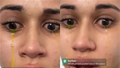 ما سبب البكاء بالدموع الصفراء؟.. خبراء يجيبون