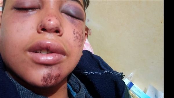 الطالب المعتدى عليه