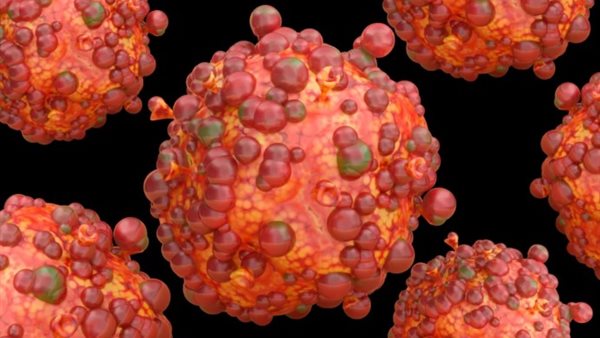 الجدري - تعبيرية