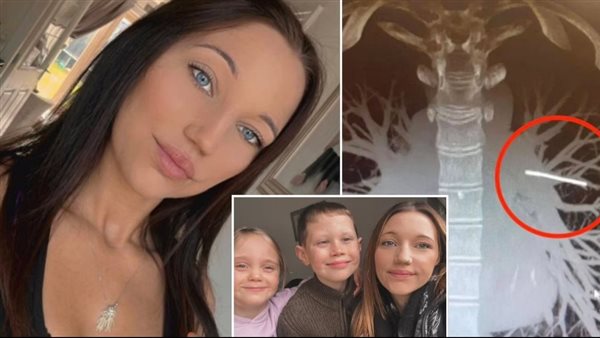 وسيلة منع حمل تستقر