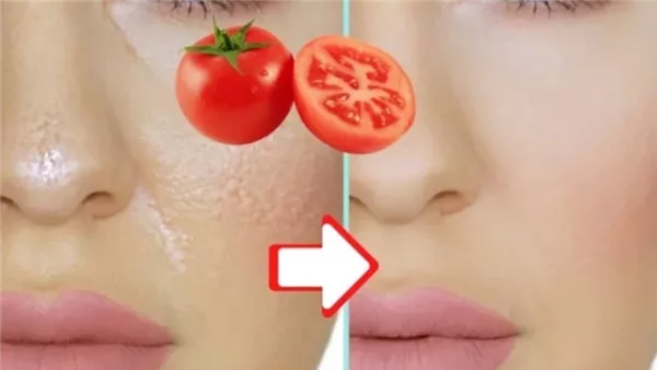 ماسك الطماطم والنشا