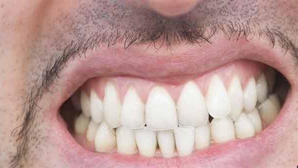 تفسير حلم سقوط الضرس