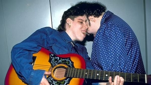 أكبر توأم ملتصق في