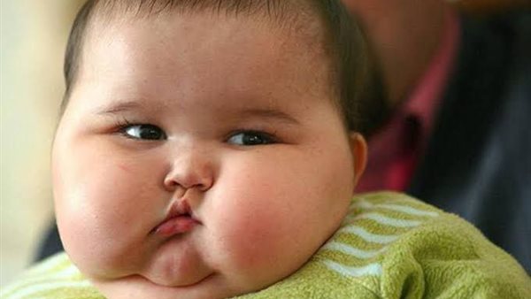 السمنة في الأطفال