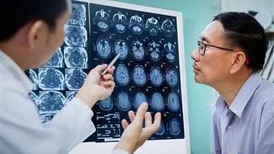 دراسة: الذكاء الاصطناعي قد يساعد أطباء الأشعة على تعزيز الكفاءة وتقليل الأخطاء