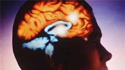 دراسة: الجراحة التي تستهدف منطقة الدماغ قد تخفف من الصرع الذي يصعب علاجه