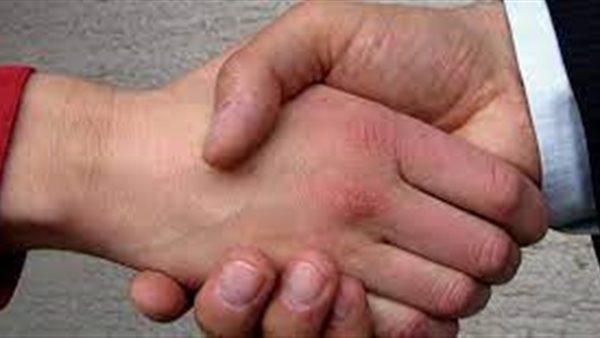 مصافحة الرجل للمرأة