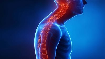 تعرف على مضاعفات الإصابة بالحداب وطرق العلاج