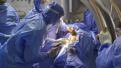 فريق طبي بقنا العام للعزل ينجح في إجرء عملية تركيب مسمار بفخذ مسن مصاب بكورونا