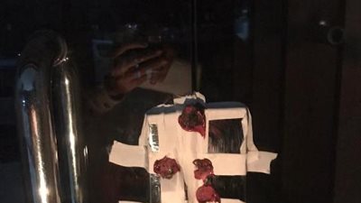 تشميع صيدلية وضبط 33 عبوة دواء وسرنجات مجهولة المصدر في الشرقية (صور)