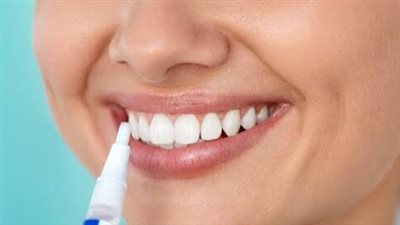 خبراء يحذرون من مخاطر أدوات تبيض الأسنان وجل الأظافر