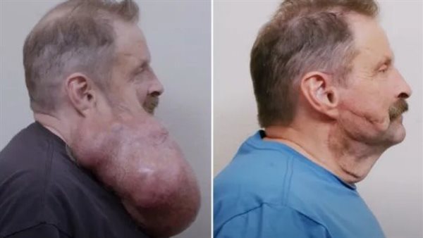 معاناة رجل أمريكي