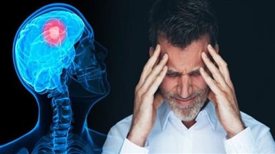 5 علامات مبكرة لسرطان المخ.. تعرف عليها