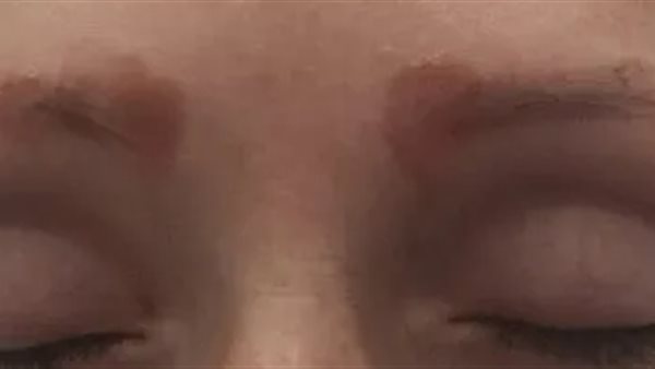 إصابة امرأتين بـ