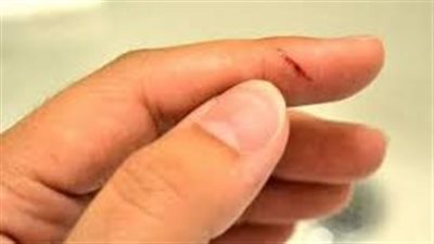 العوامل النفسية والنهايات العصبية.. ما أسباب الألم الشديد وراء إصابات قطع الورق؟