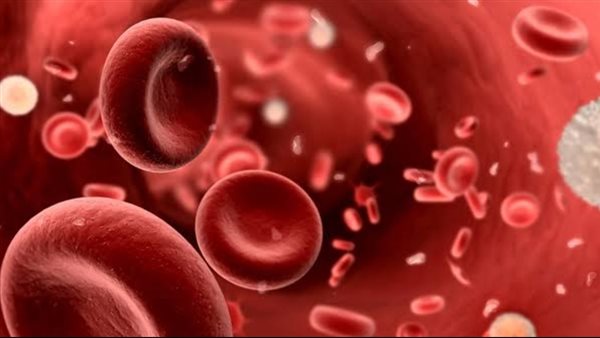 مرض الثلاسيميا -