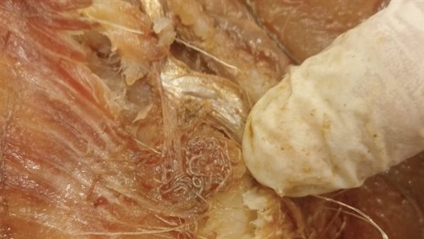 أسماك فاسدة