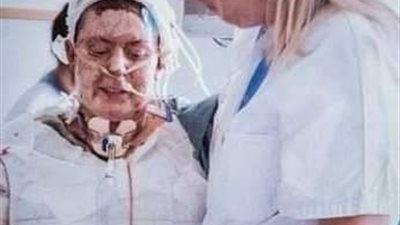 بيحرقوا نفسهم بالنار.. تحقيق يكشف تفشي ظاهرة الانتحار بين النساء في العراق بسبب العنف الأسري